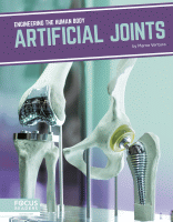 Artificial joints